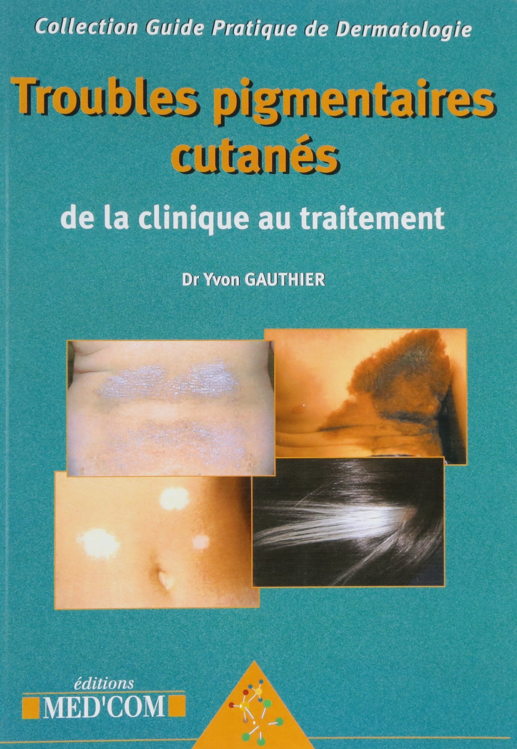 TROUBLES PIGMENTAIRES CUTANES (0000) book