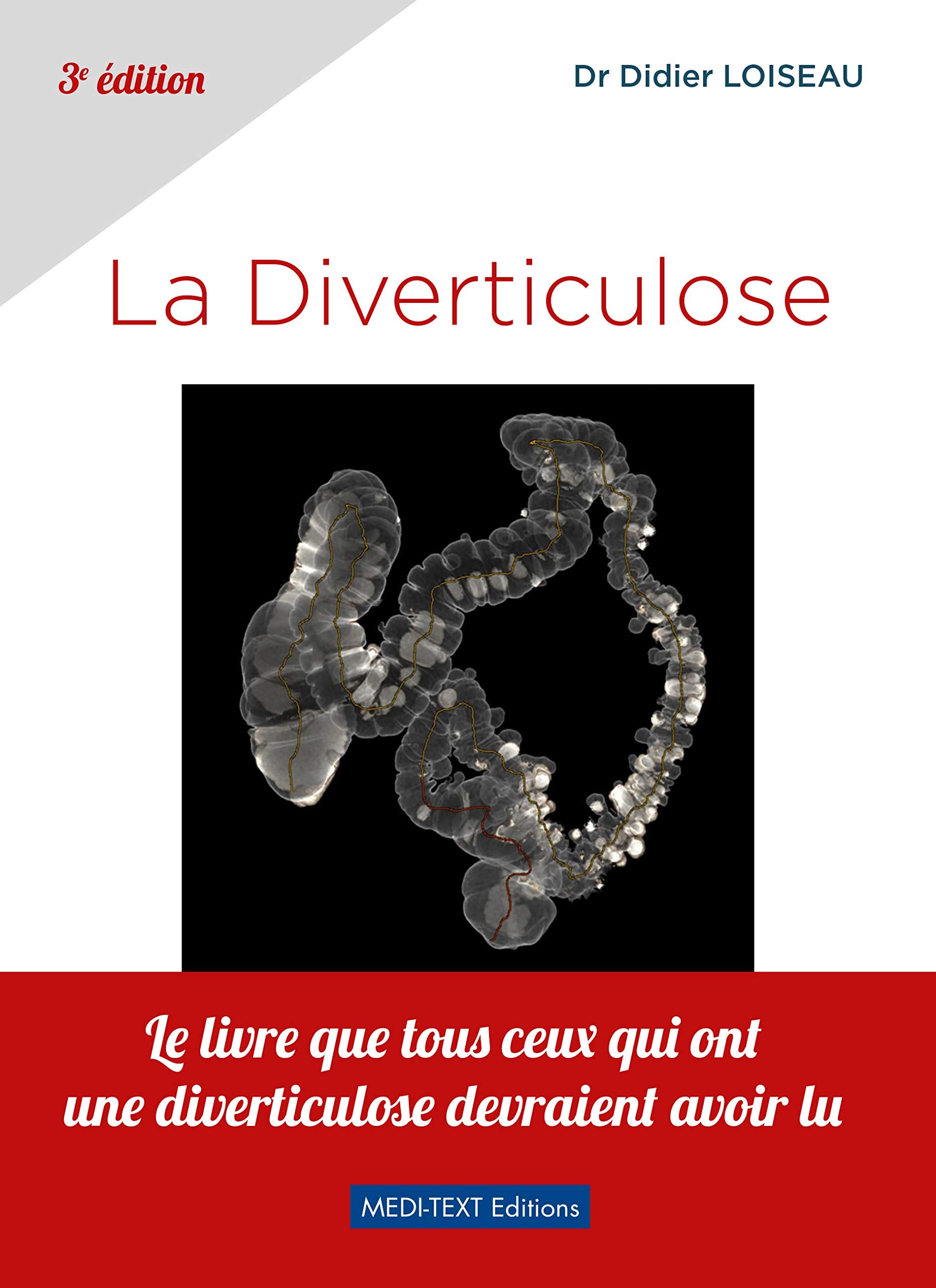 La DIVERTICULOSE: La Diverticulose - 3ème édition Medicine