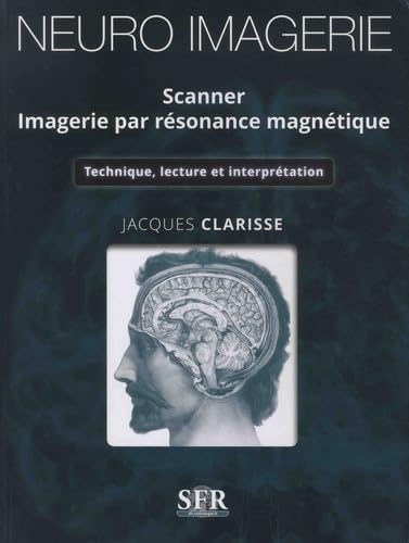 Neuro imagerie - Scanner - Imagerie par résonance magnétique: Technique, lecture et interprétation book