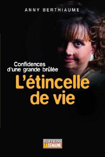 L'étincelle de vie: Confidences d'une grande brûlée (French Edition) Books