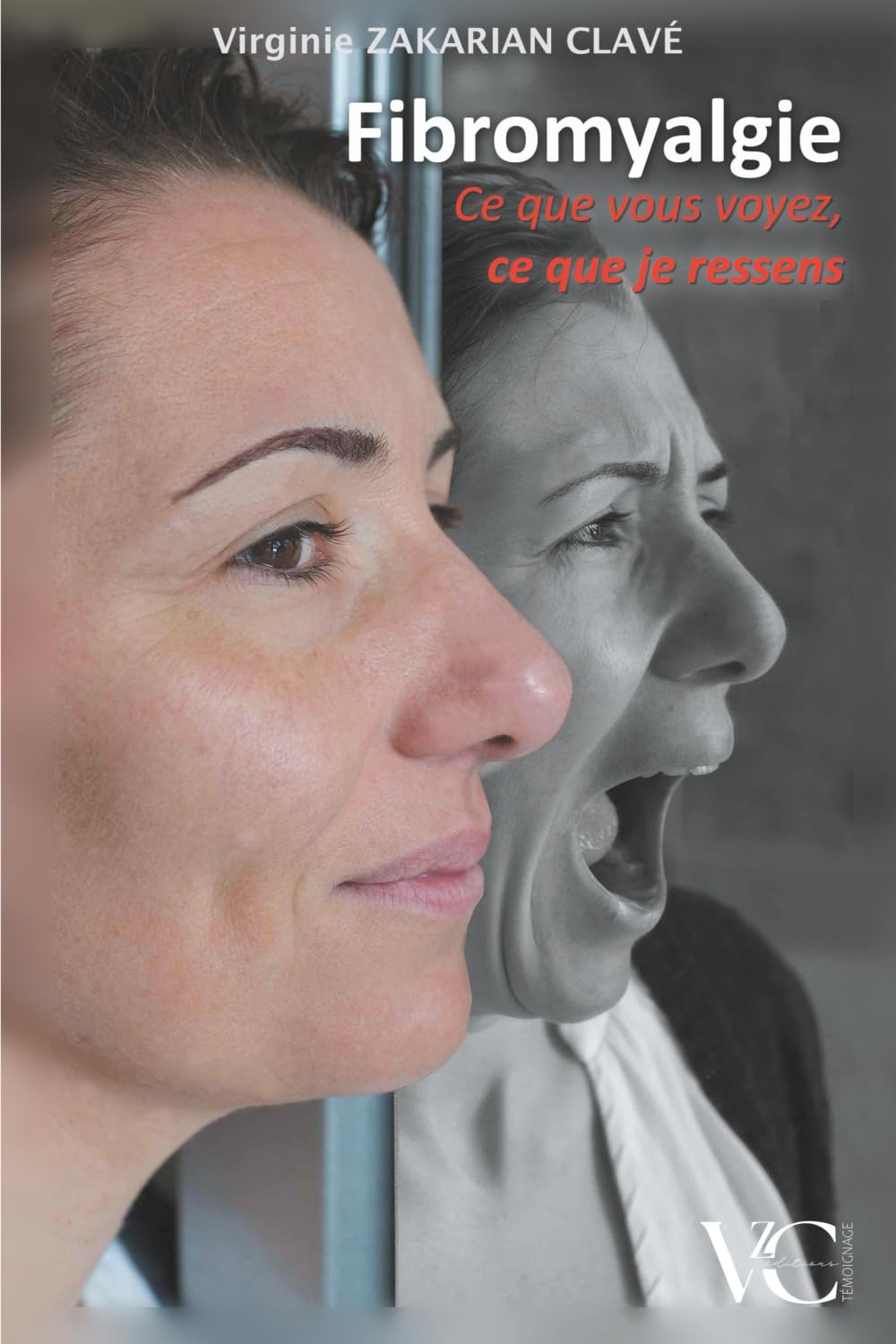 Fibromyalgie - Ce que vous voyez, ce que je ressens. Photography
