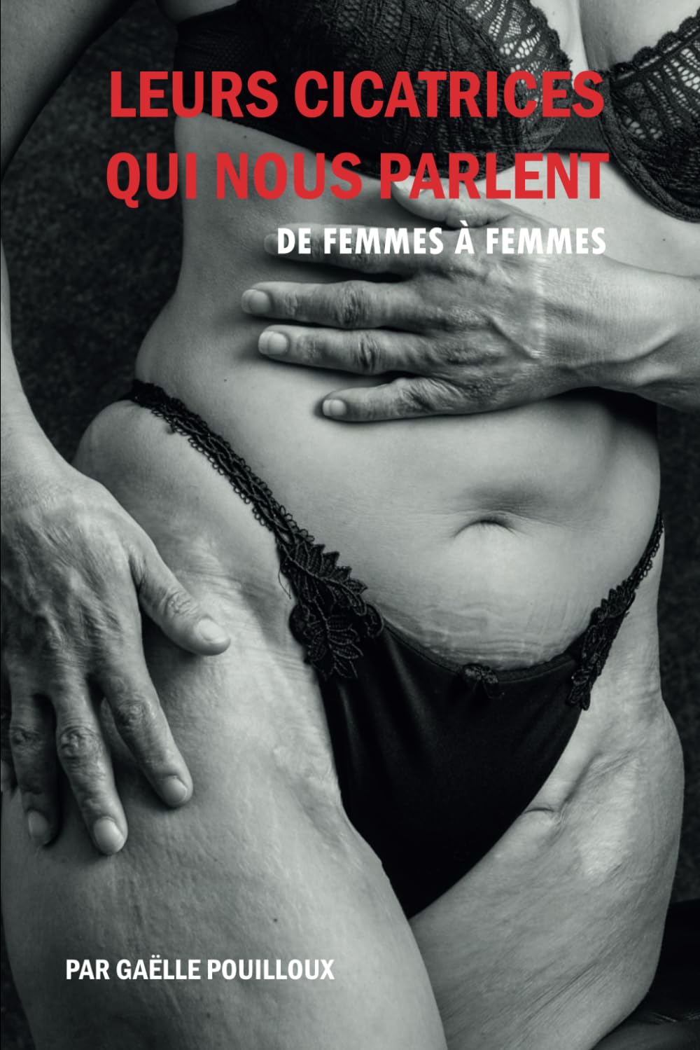 Leurs cicatrices qui nous parlent: De femmes à femmes Lifestyle