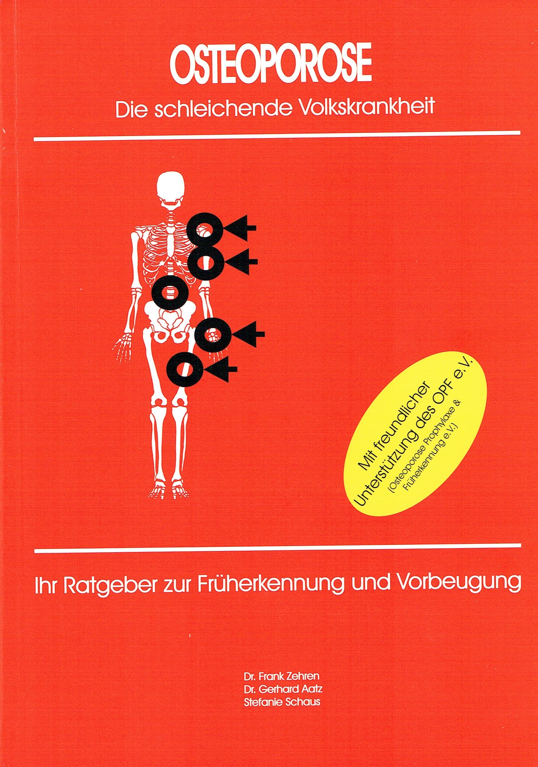 OSTEOPOROSE - Die schleichende Volkskrankheit Books
