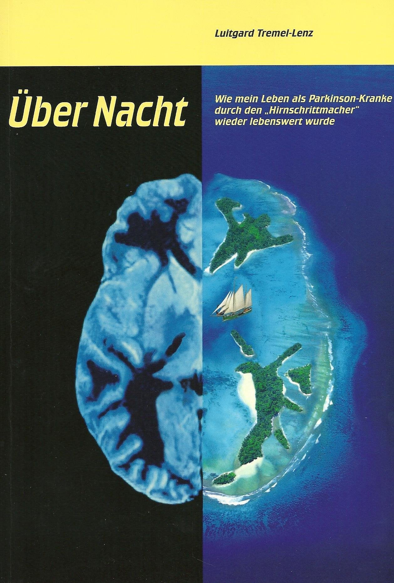 Über Nacht. Wie mein Leben als Parkinson-Kranke durch den "Hirnschrittmacher" wieder lebenswert wurde Books
