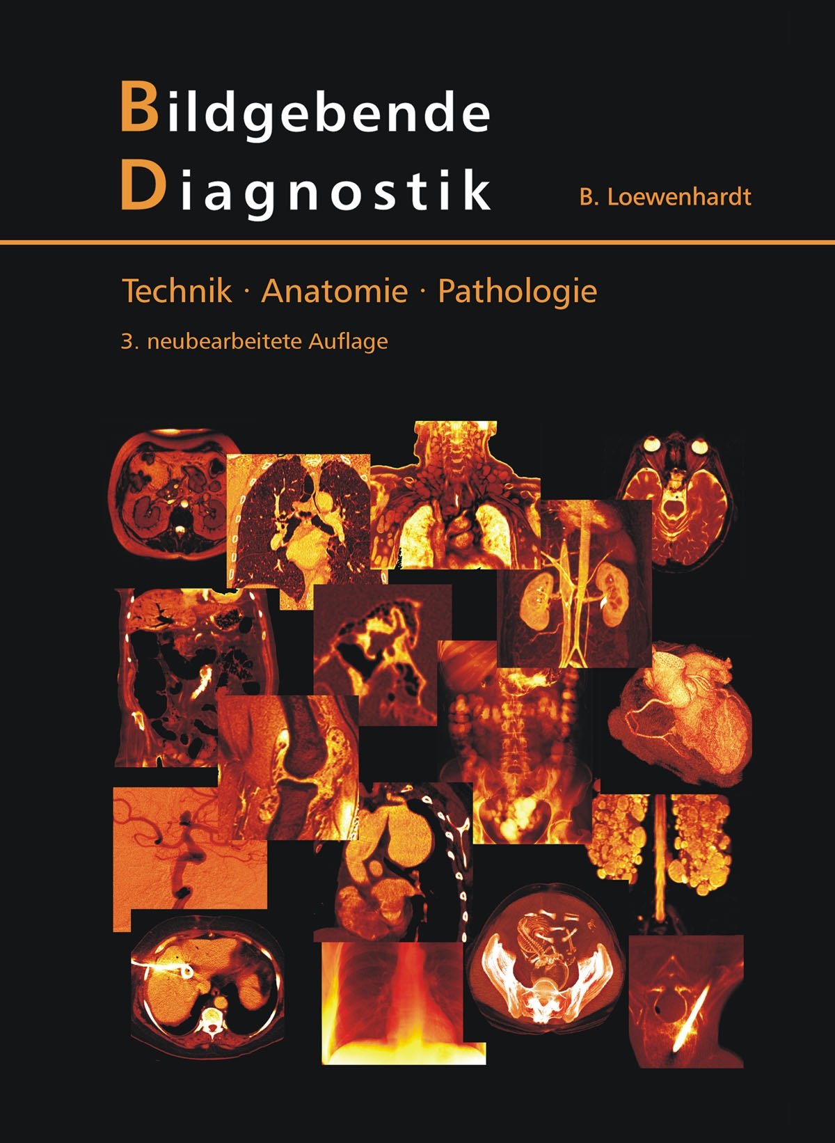 Bildgebende Diagnostik: Technik - Anatomie - Pathologie Medicine
