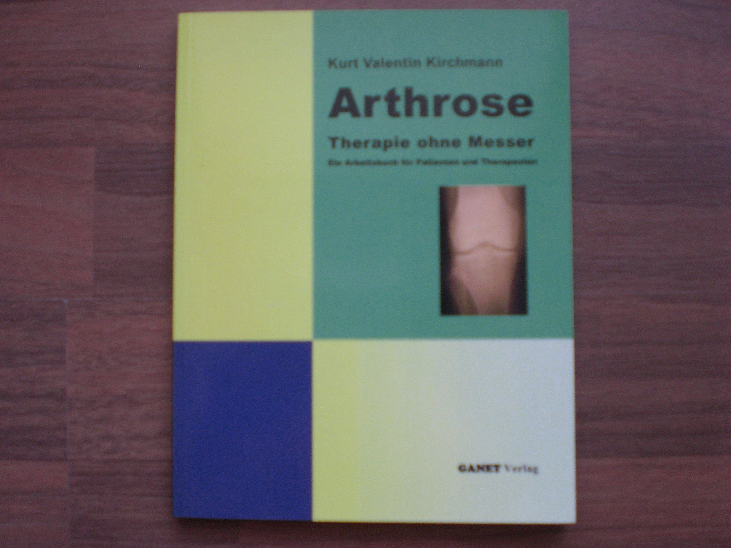 Product Image: Arthrose Therapie ohne Messer