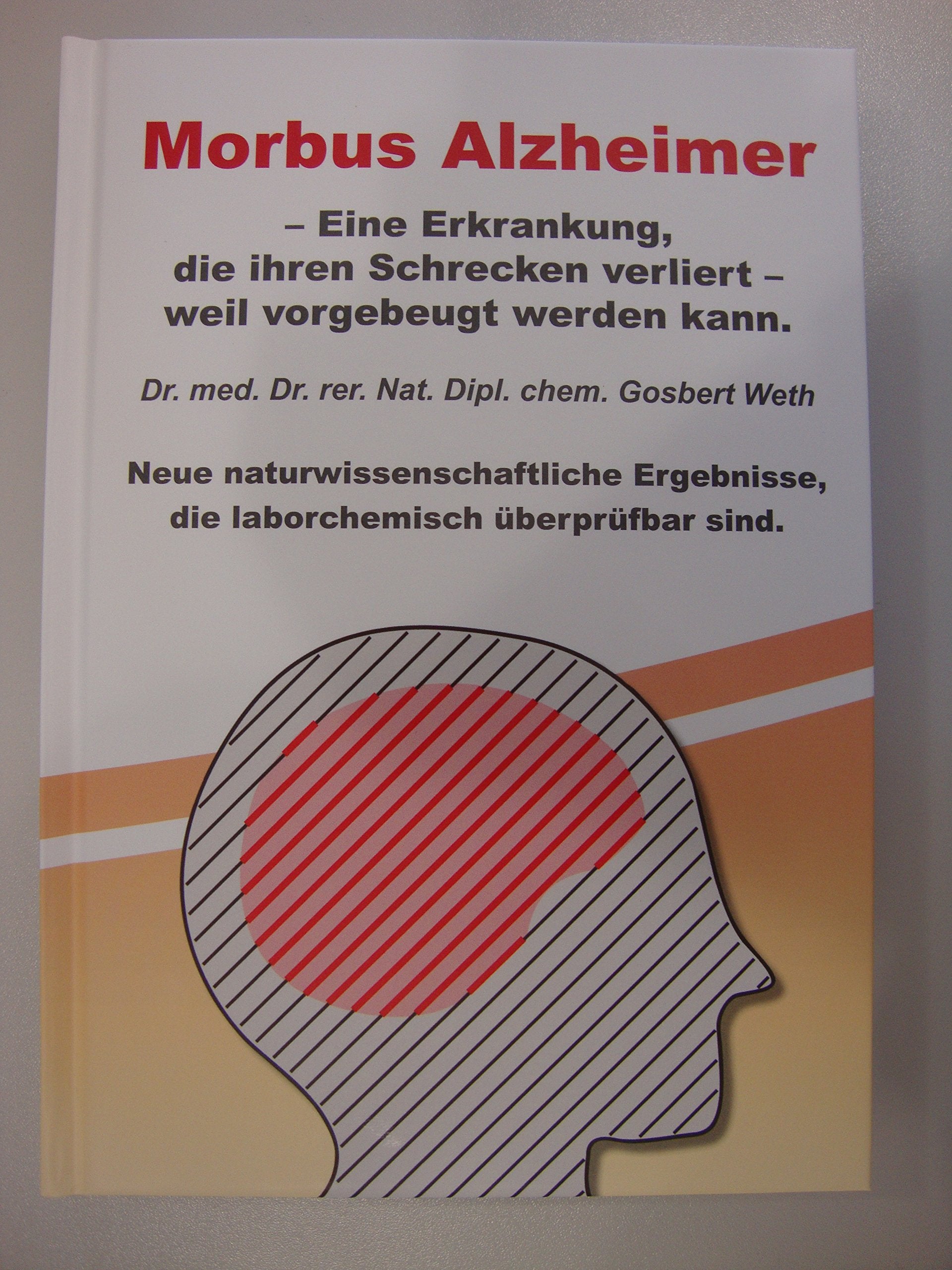 Morbus Alzheimer: Eine Erkrankung, die ihren Schrecken verliert - weil vorgebeugt werden kann Medicine