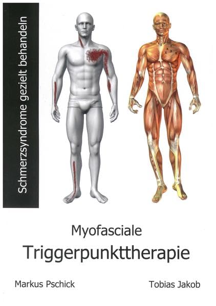 Myofasciale Triggerpunkttherapie: Schmerzsyndrome gezielt behandeln Medicine