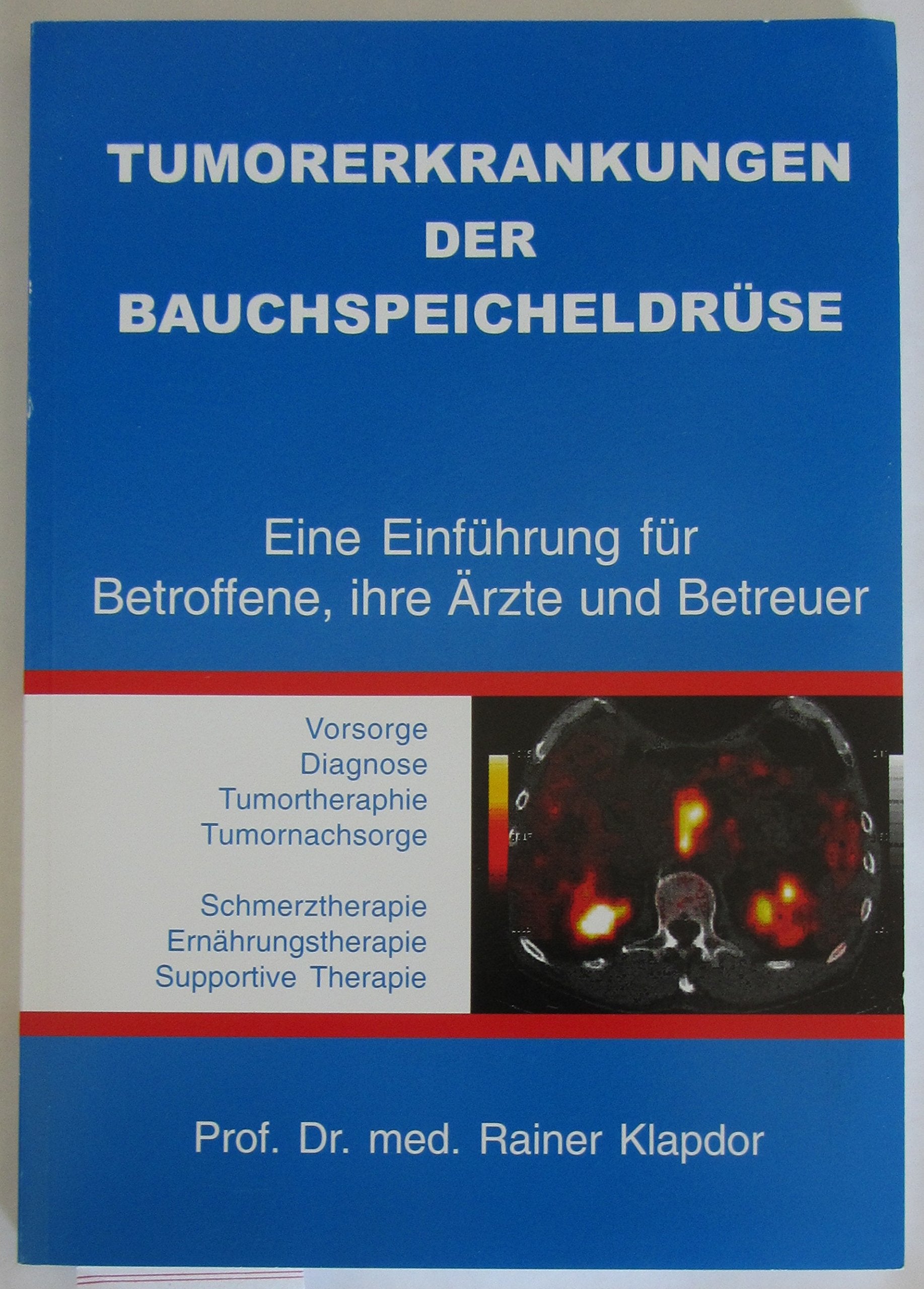 Tumorerkrankungen der Bauchspeicheldrüse: Eine Einführung für Betroffene, ihre Ärzte und Betreuer Medicine