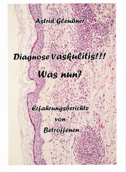 Diagnose Vaskulitis!!! Was nun?: Erfahrungsberichte von Betroffenen Medicine