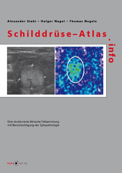 Schilddrüse-Atlas.info: Eine strukturierte klinische Fallsammlung mit Berücksichtigung der Zytopathologie Medicine
