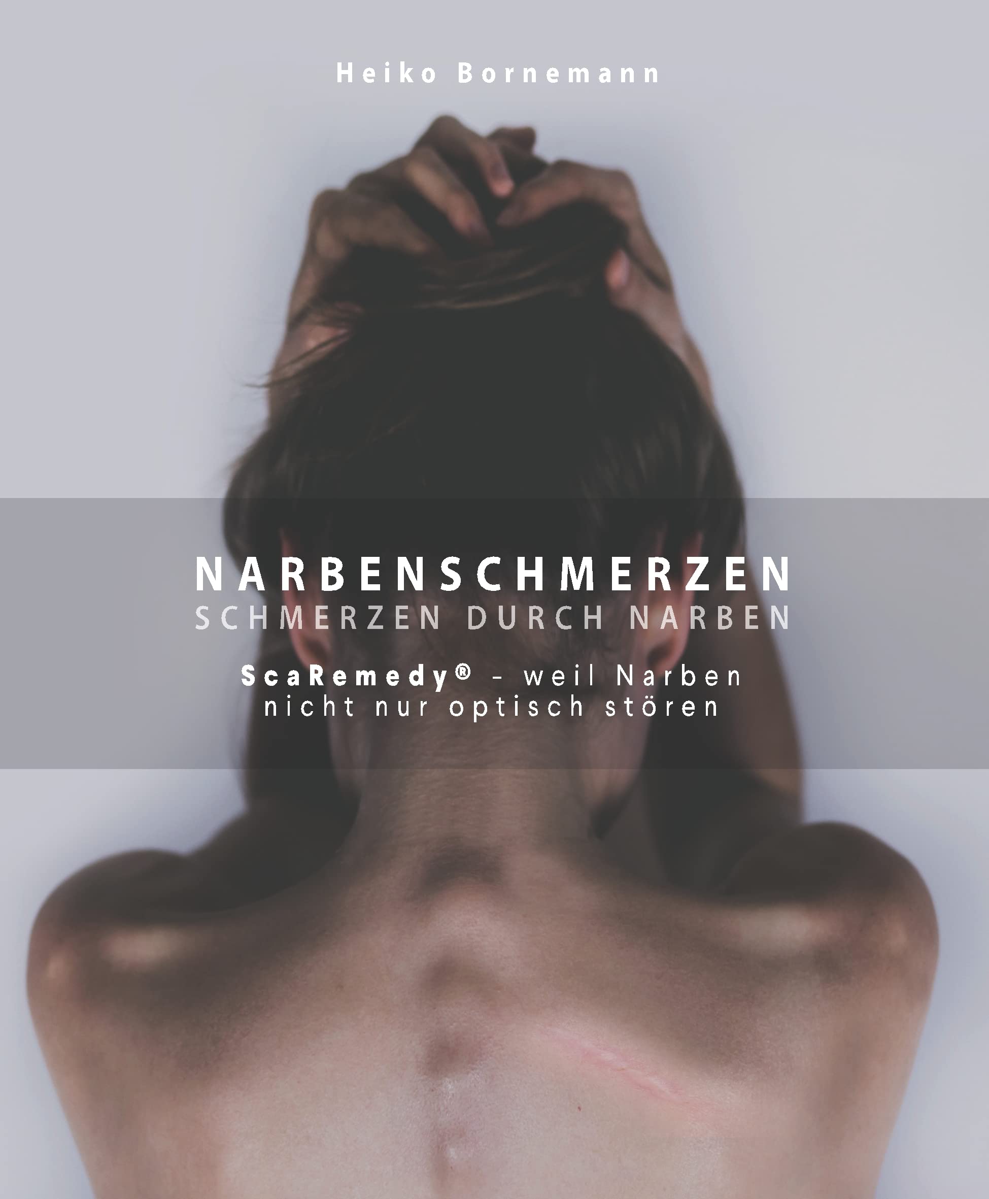 Narbenschmerzen - Schmerzen durch Narben: ScaRemedy - weil Narben nicht nur optisch stören Medicine