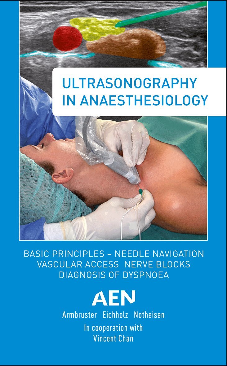 Ultrasonography in Anaesthesiology: Basic Principles - Needle Navigation, Vascular Access, Nerve Blocks, Diagnosis of Dyspnoea Medicine