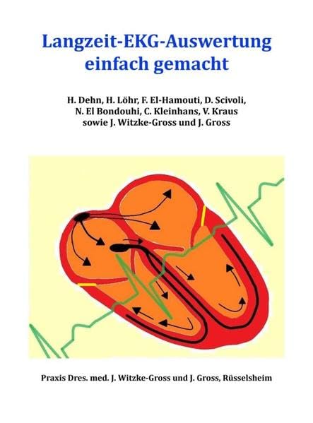 Langzeit-EKG-Auswertung einfach gemacht Medicine