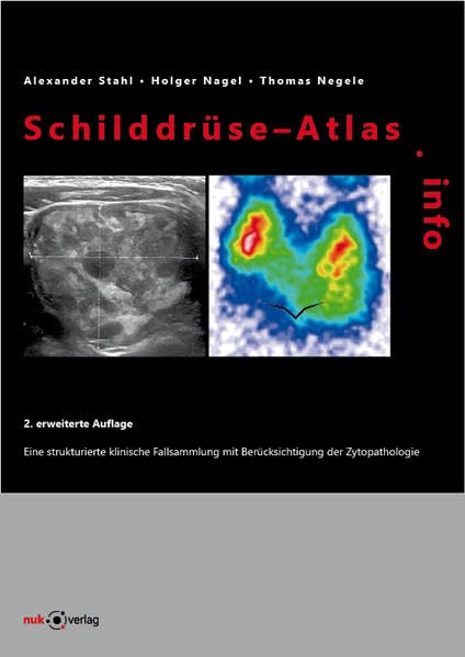Schilddrüse-Atlas.info: Eine strukturierte klinische Fallsammlung mit Berücksichtigung der Zytopathologie Medicine