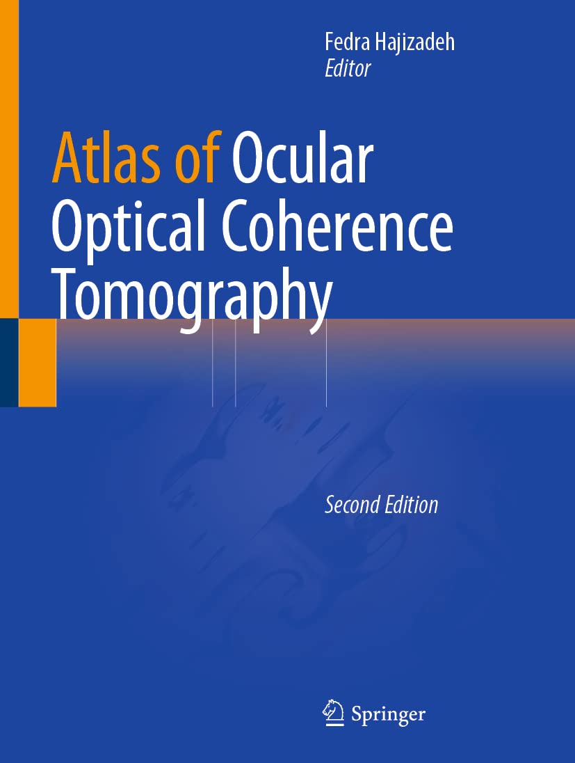 Atlas of Ocular Optical Coherence Tomography Medicine