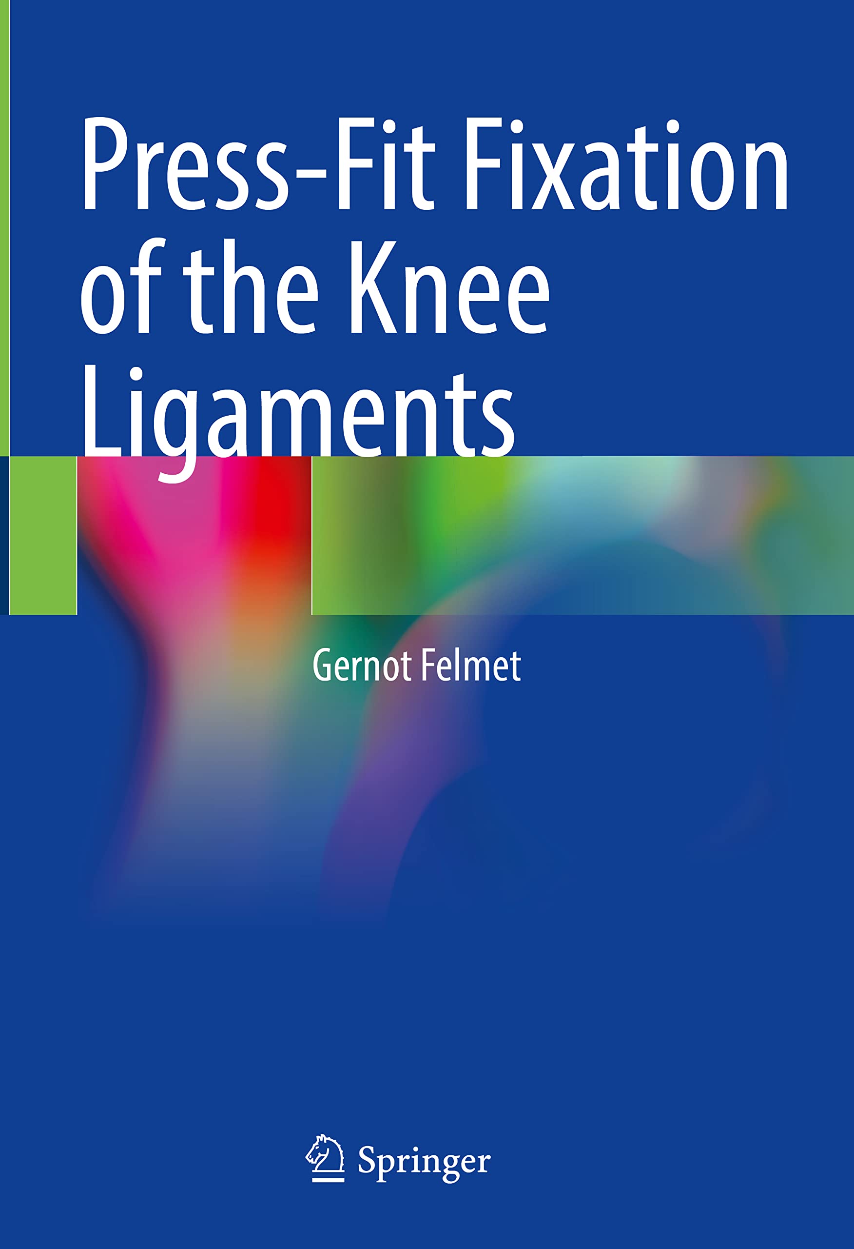 Press-Fit Fixation of the Knee Ligaments Medicine