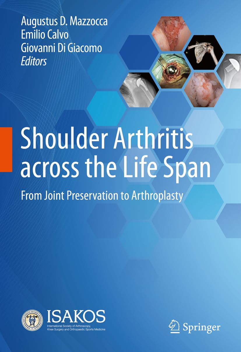 Shoulder Arthritis across the Life Span: From Joint Preservation to Arthroplasty Medicine