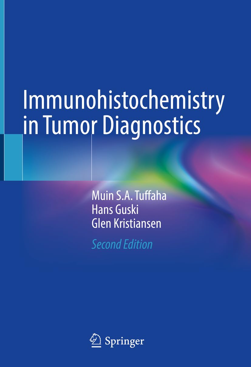 Immunohistochemistry in Tumor Diagnostics Medicine