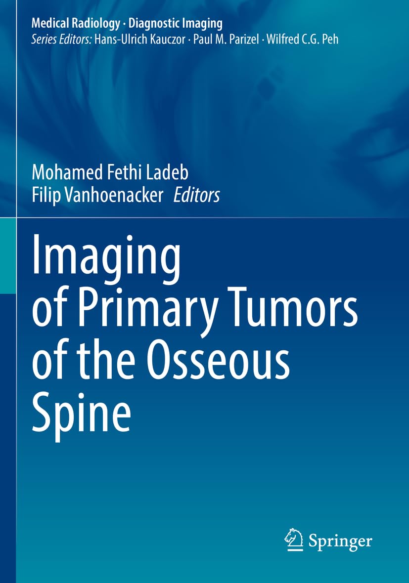 Imaging of Primary Tumors of the Osseous Spine Medicine