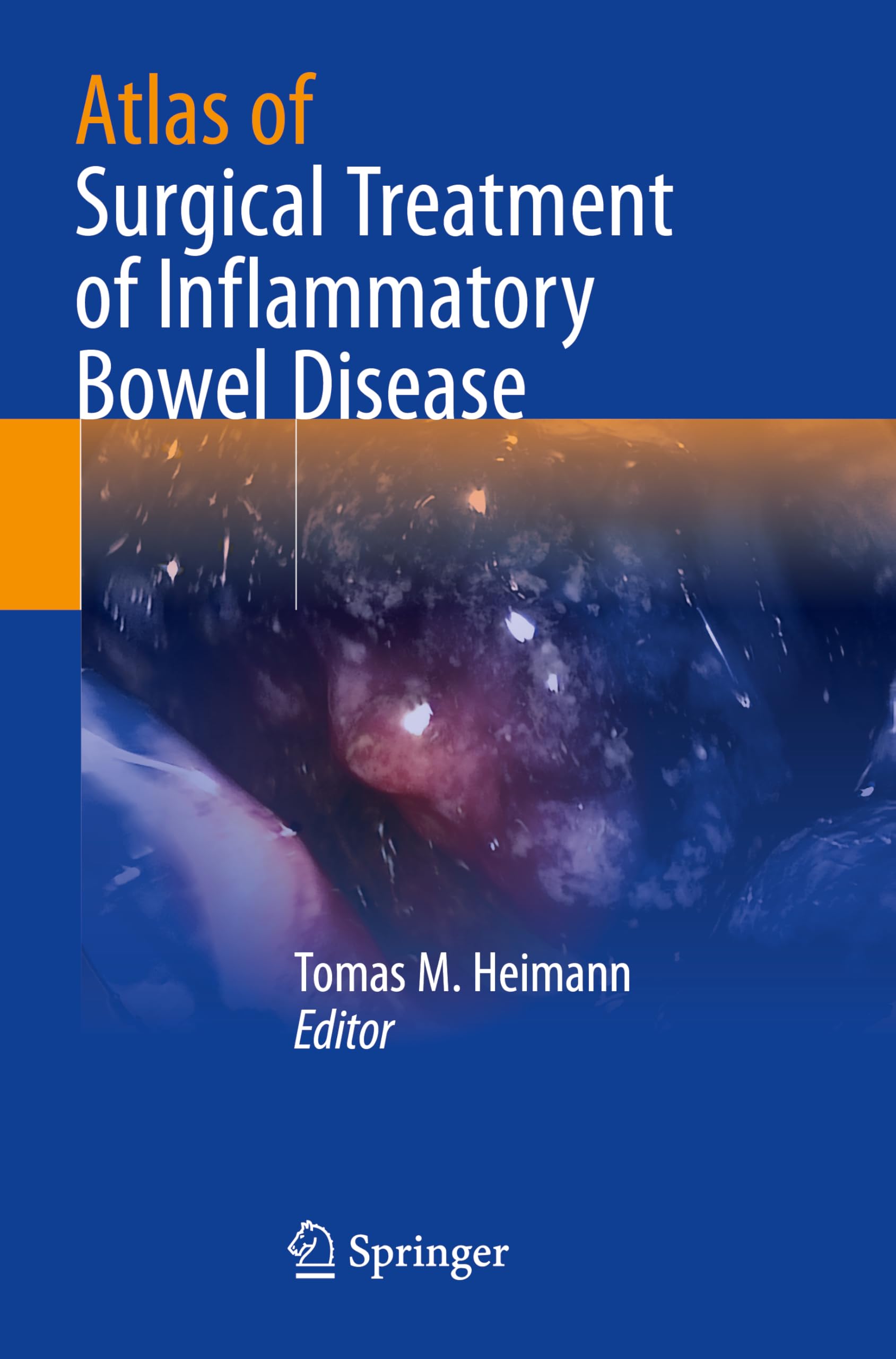 Atlas of Surgical Treatment of Inflammatory Bowel Disease Medicine