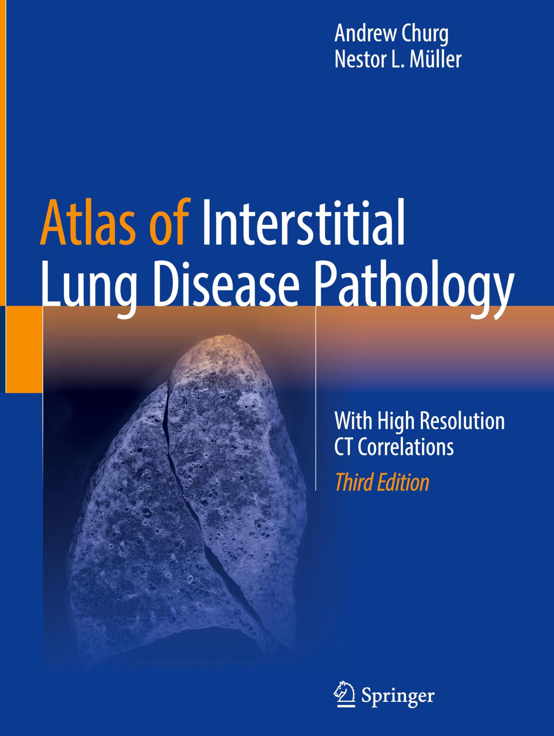 Atlas of Interstitial Lung Disease Pathology Medicine