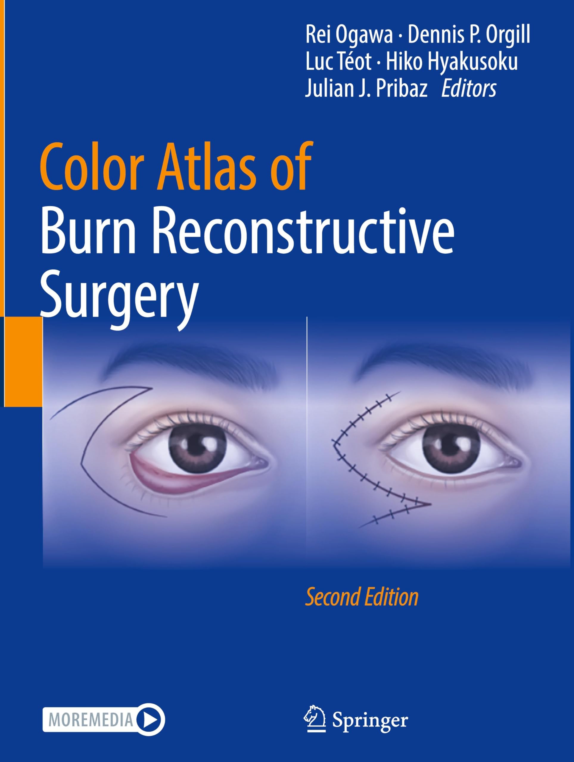Color Atlas of Burn Reconstructive Surgery Medicine