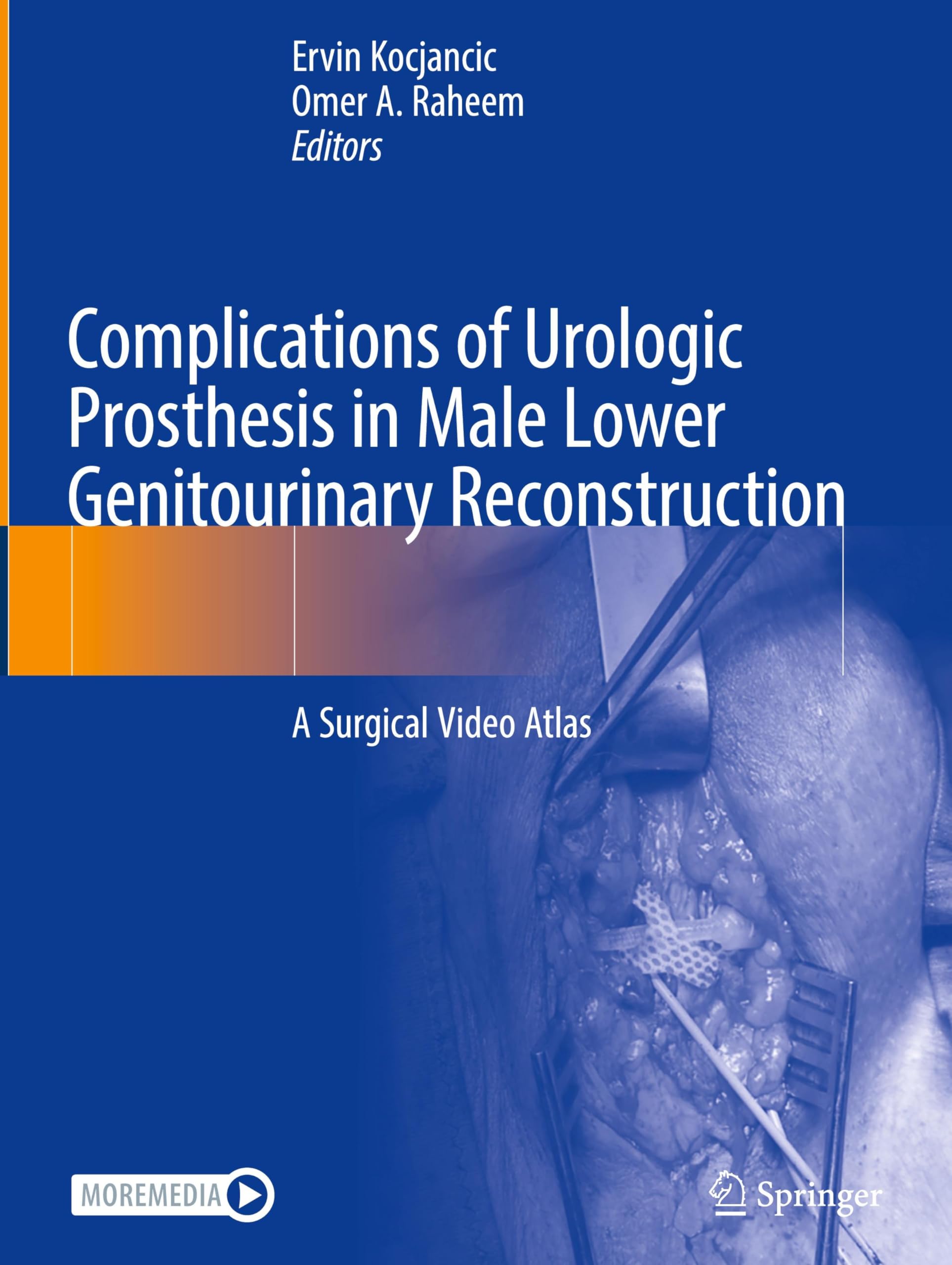 Complications of Urologic Prosthesis in Male Lower Genitourinary Reconstruction Medicine