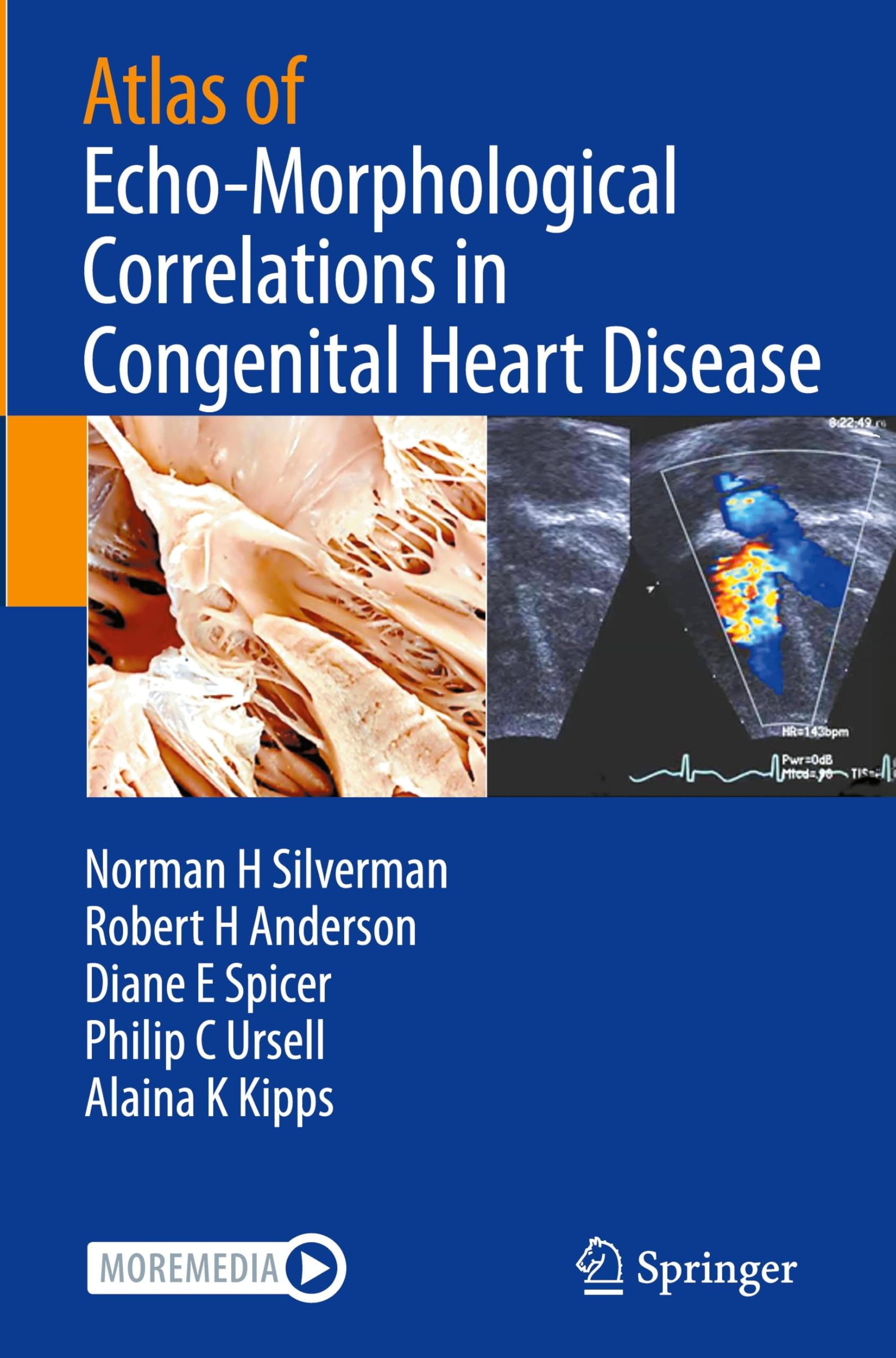 Atlas of Echo-Morphological Correlations in Congenital Heart Disease Medicine