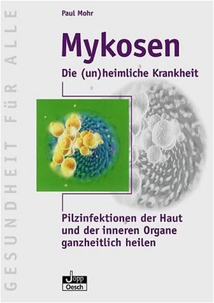 Mykosen: Die (un)heimliche Krankheit (Gesundheit für Alle) Medicine