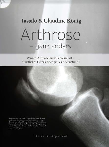 Arthrose – ganz anders: Warum Arthrose nicht Schicksal ist – Künstliches Gelenk oder gibt es Alternativen? Medicine