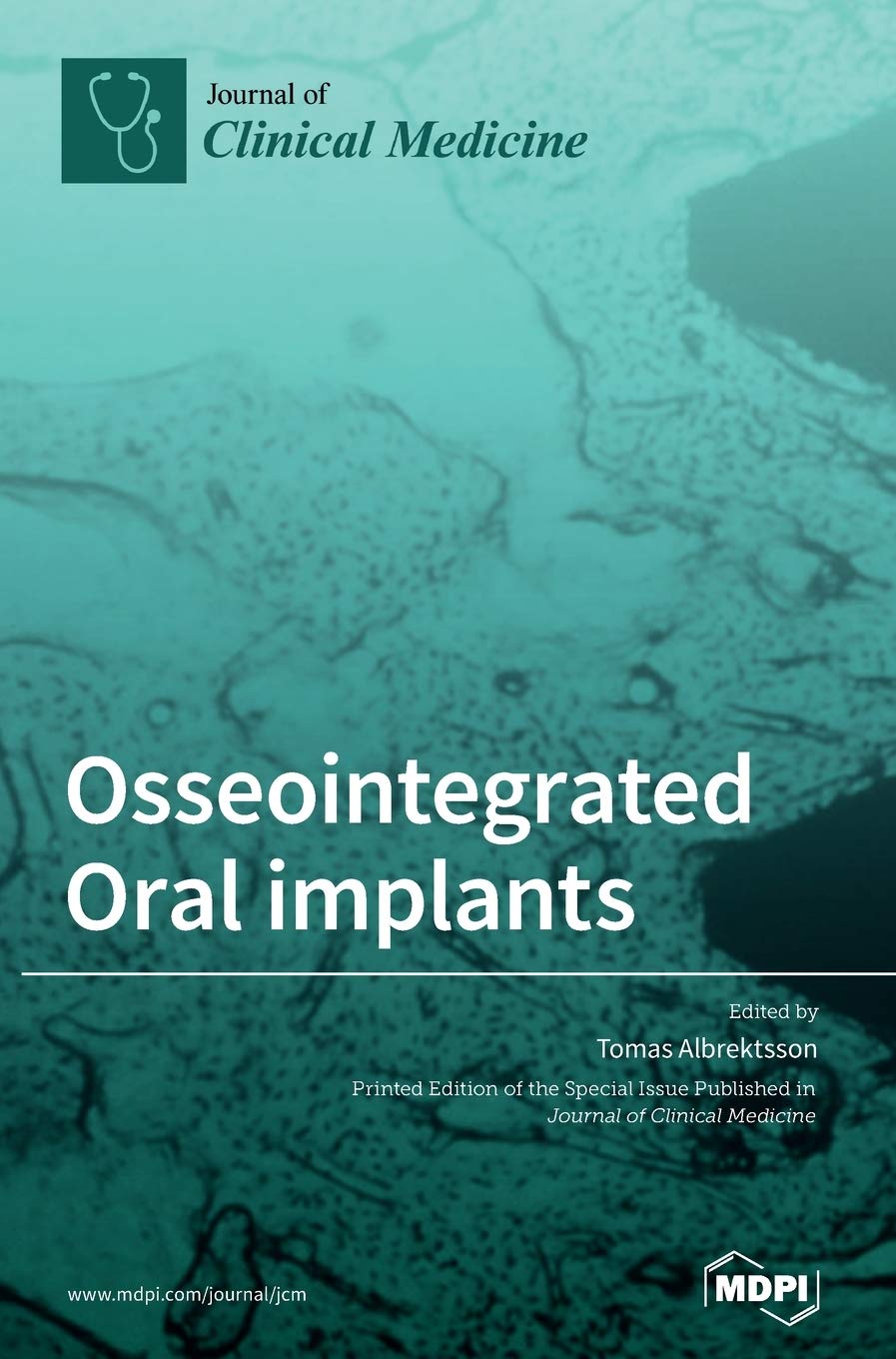 Product Image: Osseointegrated Oral implants