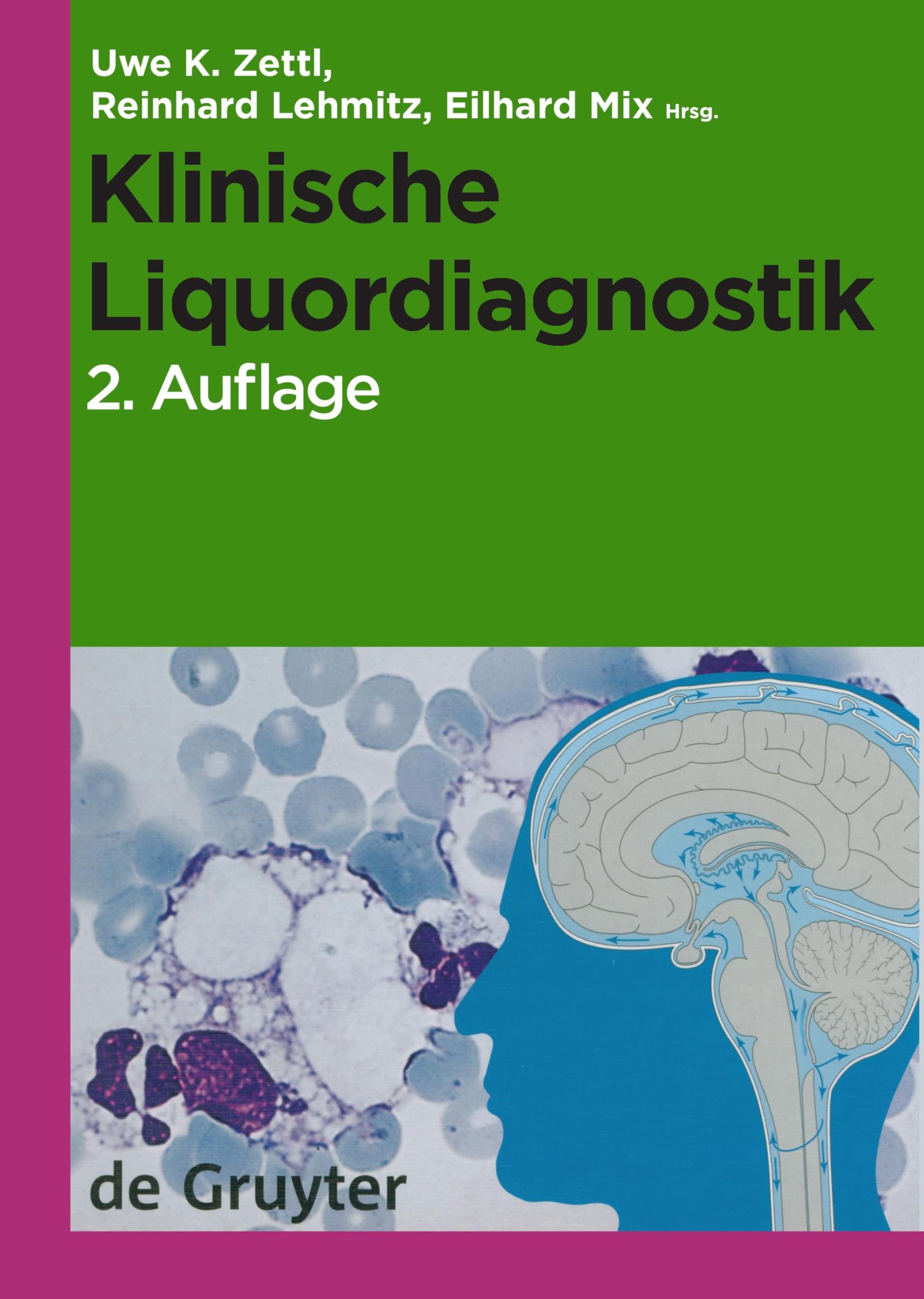 Klinische Liquordiagnostik Medicine