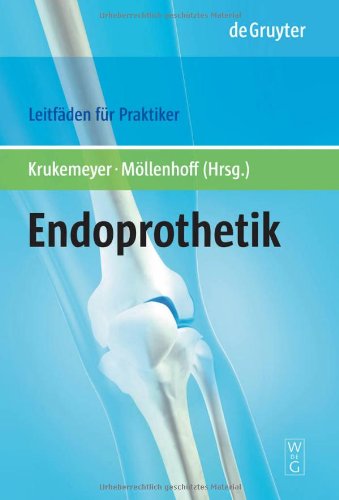 Endoprothetik (Leitfäden für den Praktiker) Medicine