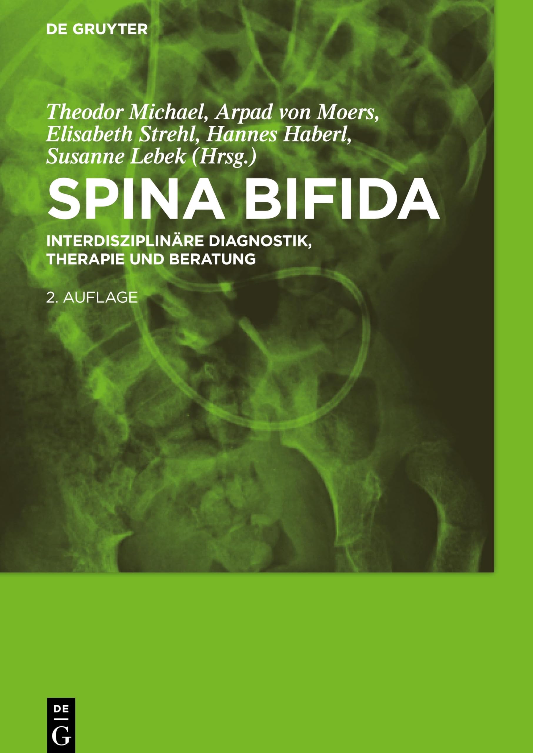 Spina bifida: Interdisziplinäre Diagnostik, Therapie und Beratung Medicine