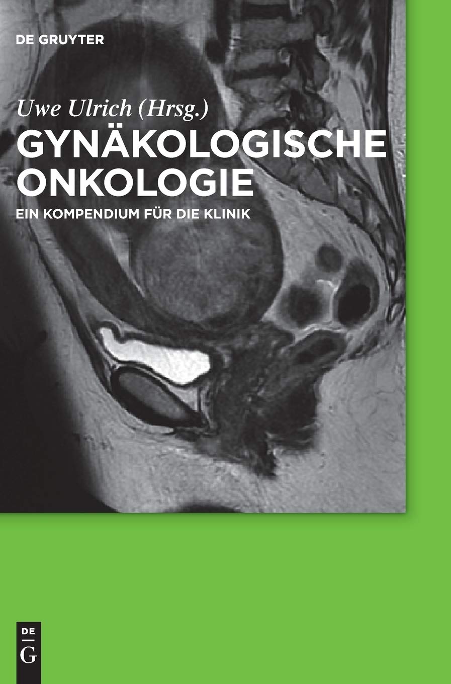 Gynäkologische Onkologie: Ein Kompendium für die Klinik Medicine