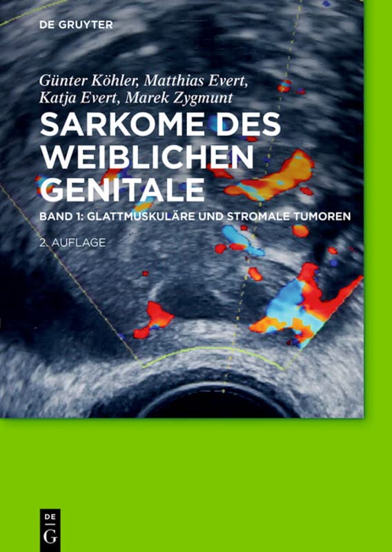 Glattmuskuläre und stromale Tumoren (Sarkome des weiblichen Genitale) Medicine