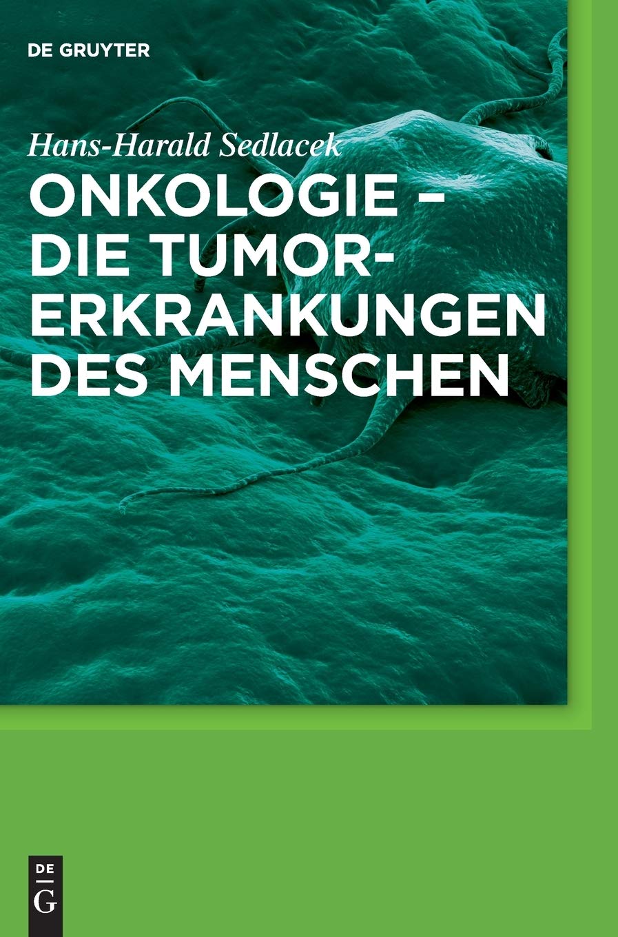 Onkologie - die Tumorerkrankungen des Menschen: Entstehung, Abwehr und Behandlungsmöglichkeiten Medicine