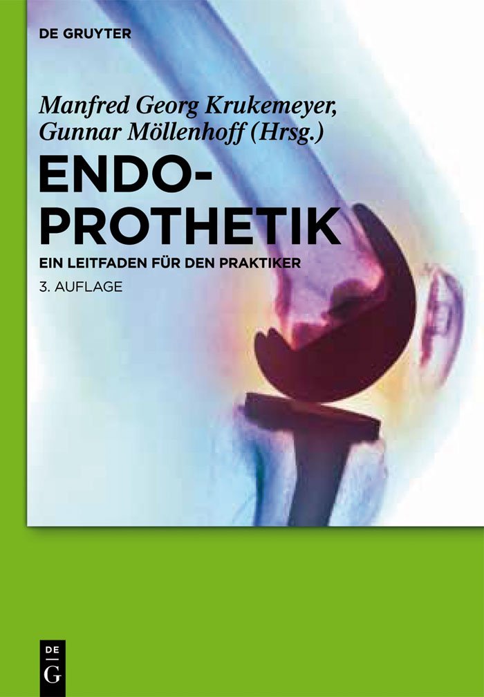 Endoprothetik: Ein Leitfaden für den Praktiker Medicine