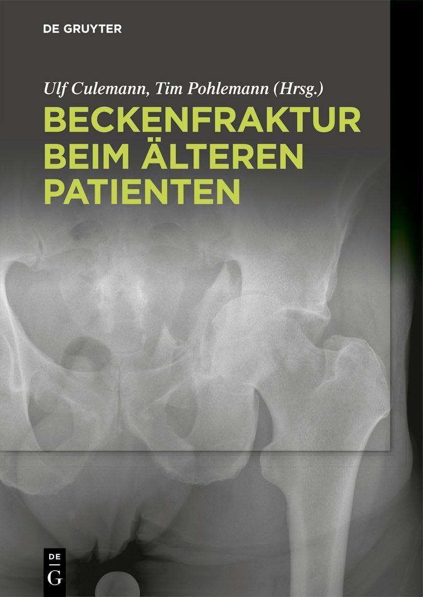 Beckenfraktur beim älteren Patienten Medicine
