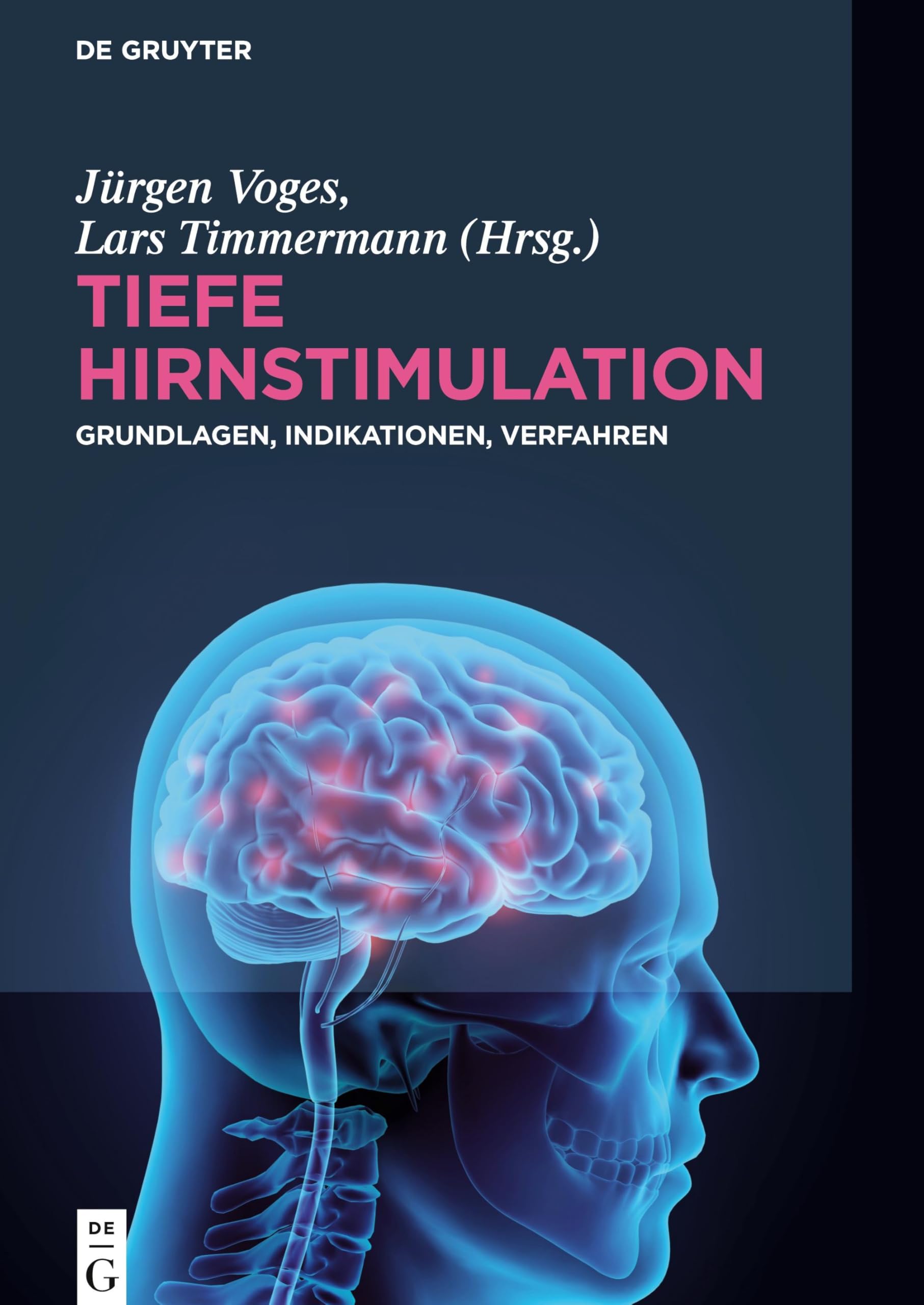 Tiefe Hirnstimulation: Grundlagen, Indikationen, Verfahren Medicine