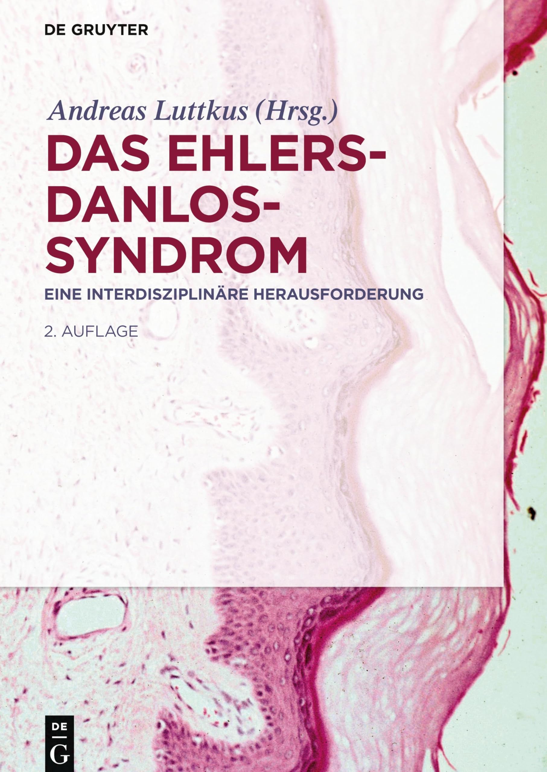 Das Ehlers-Danlos-Syndrom: Eine interdisziplinäre Herausforderung Medicine