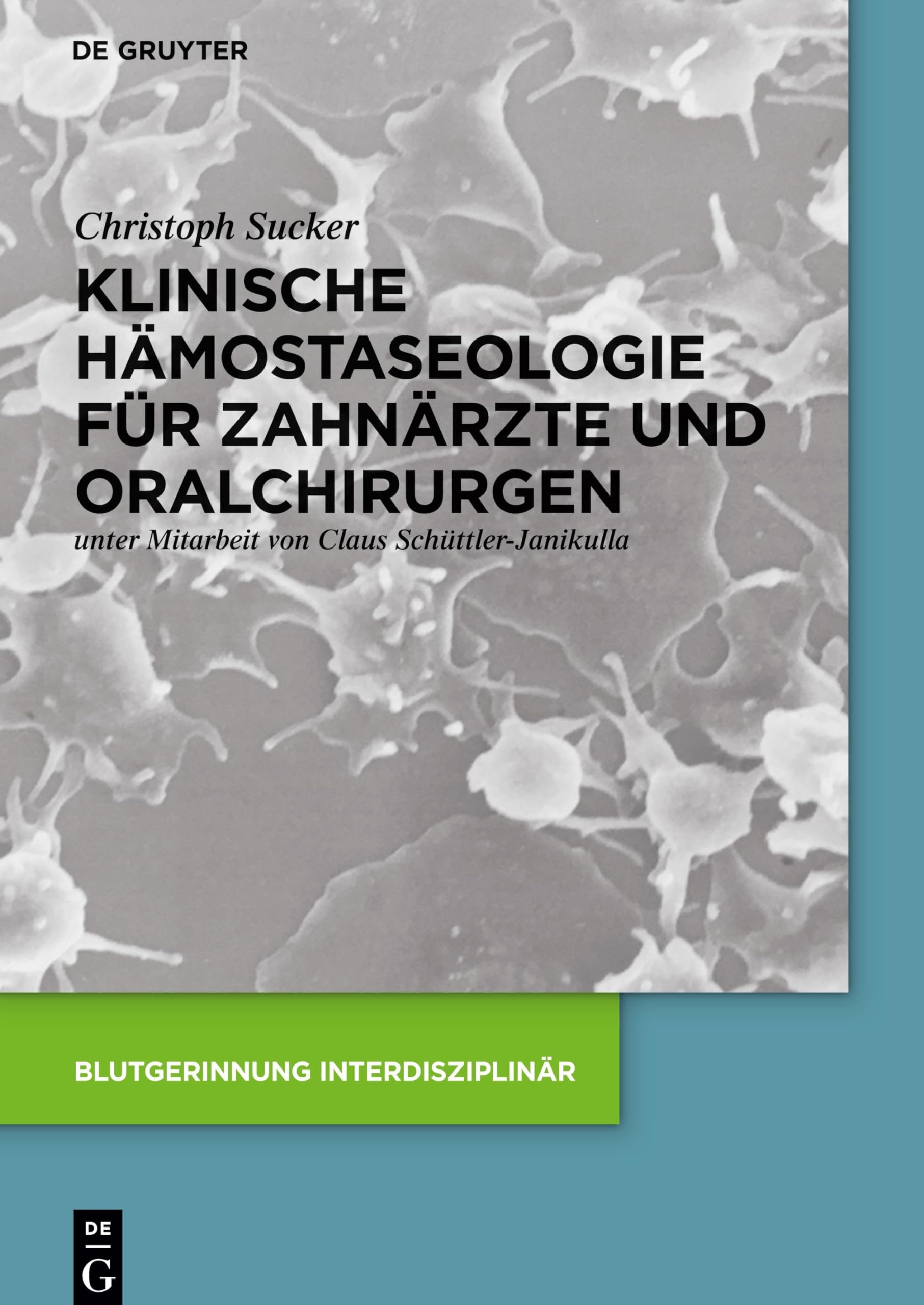Klinische Hämostaseologie für Zahnärzte und Oralchirurgen (Blutgerinnung interdisziplinär) Medicine