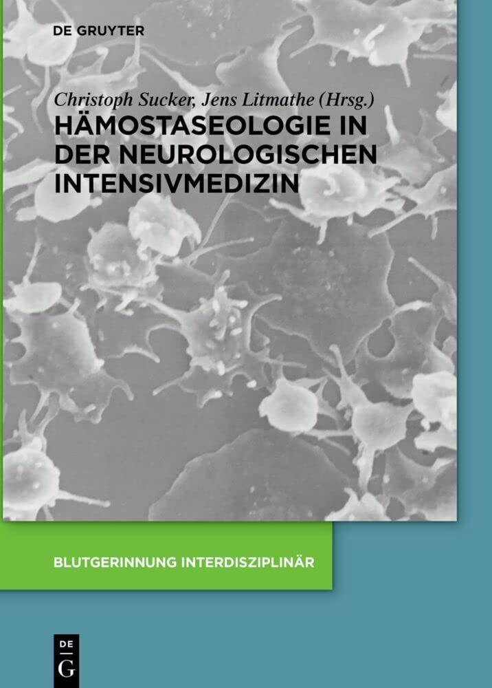 Hämostaseologie in der neurologischen Intensivmedizin (Blutgerinnung interdisziplinär) Medicine