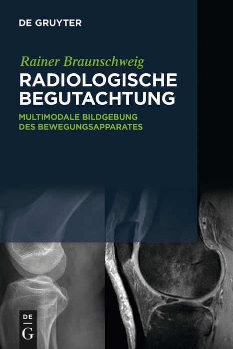 Radiologische Begutachtung: Multimodale Bildgebung des Bewegungsapparates Medicine
