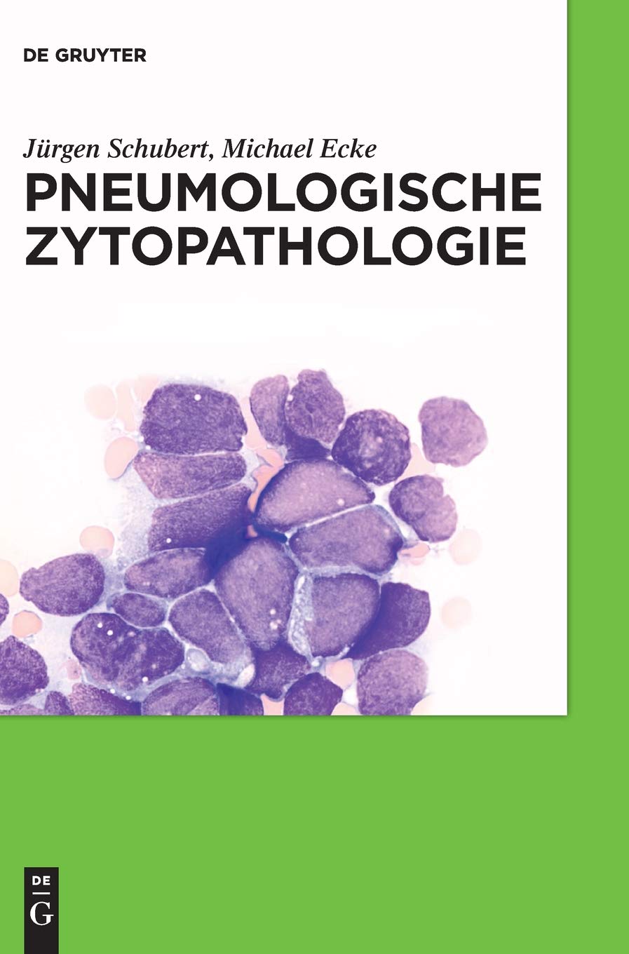 Pneumologische Zytopathologie Medicine