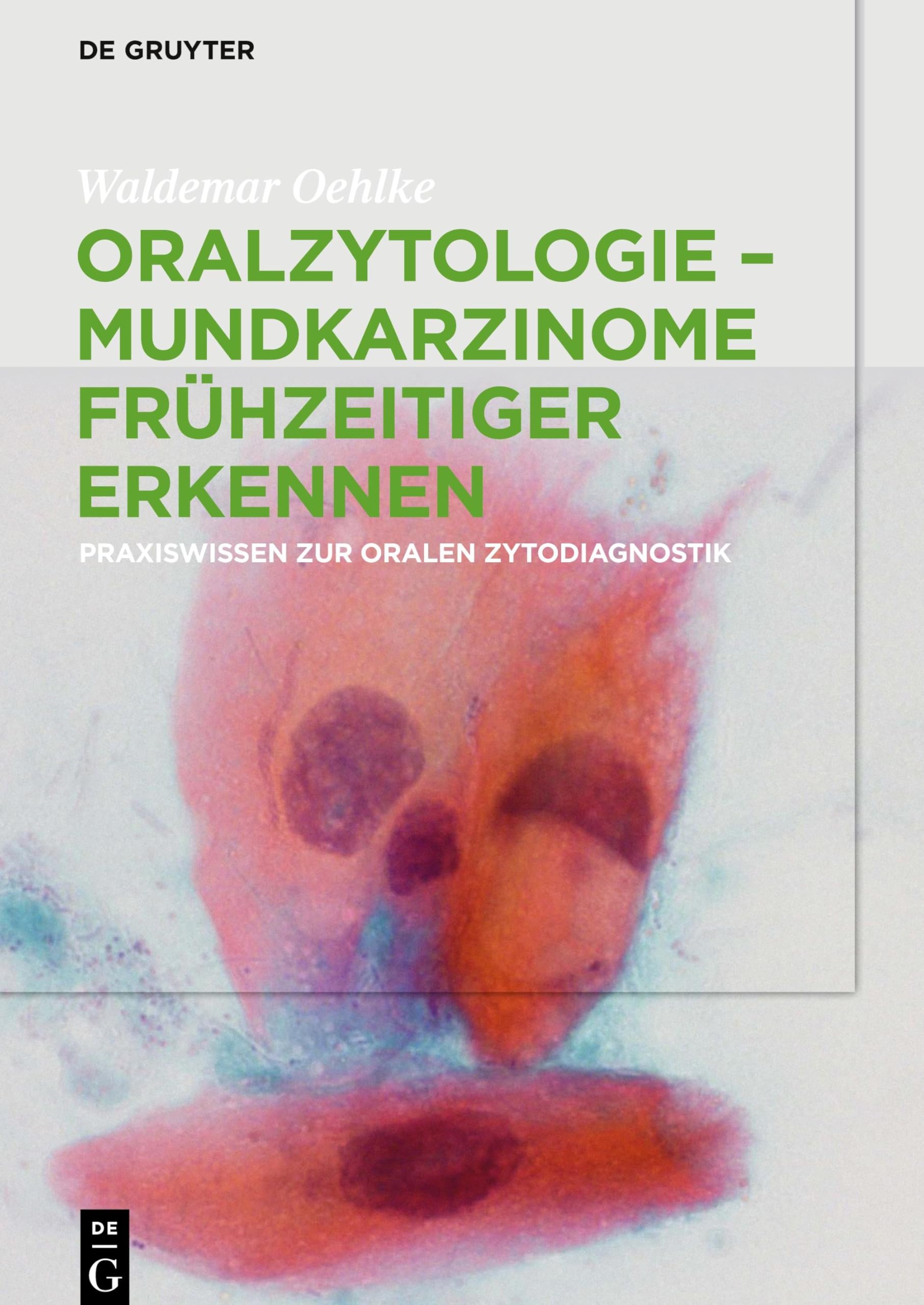 Oralzytologie - Mundkarzinome frühzeitiger erkennen: Praxiswissen zur Oralen Zytodiagnostik Medicine