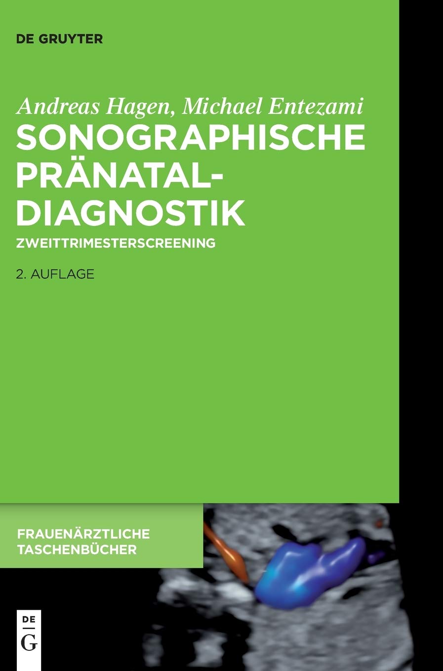 Sonographische Pränataldiagnostik: Zweittrimesterscreening book