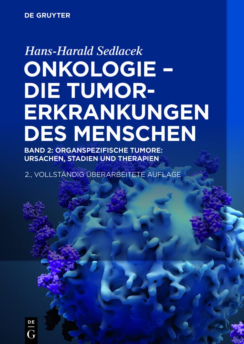 Oganspezifische Tumore: Ursachen, Stadien Und Therapien book