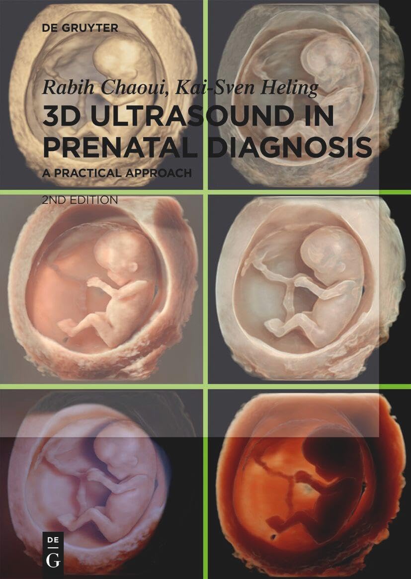 3D Ultrasound in Prenatal Diagnosis: A Practical Approach Medicine